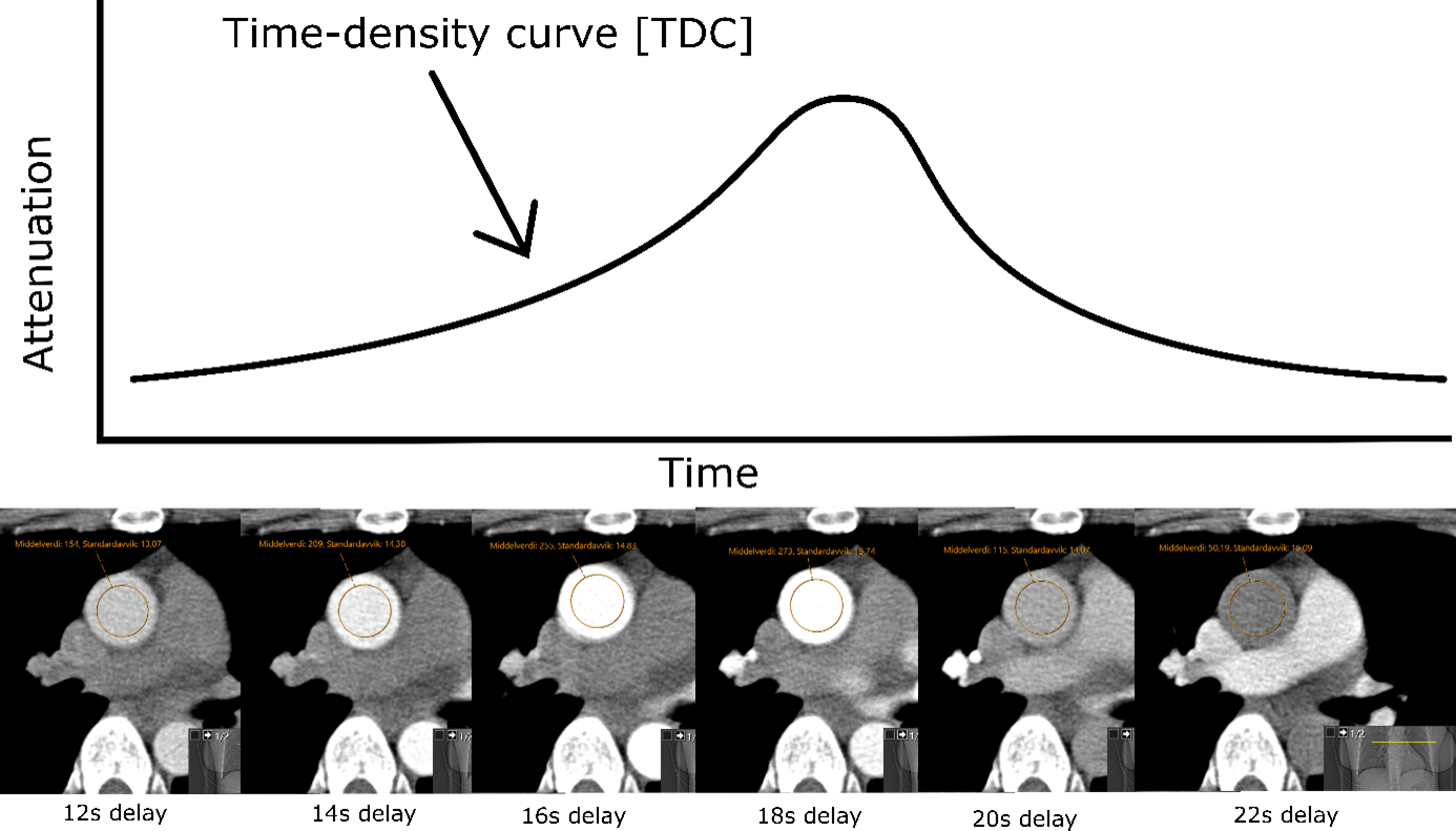 In a CT examination of the heart, it is desirable to achieve a good contrast charge in the blood vessels without giving more contrast than necessary. 